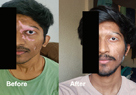 skin specialist in pune